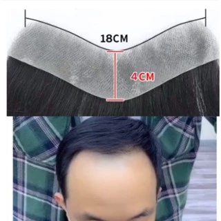 Toupee วิกผมสั้น 100% สไตล์ V สไตล์ I Style M สําหรับผู้ชาย 6"