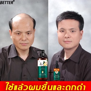 BETTER【2 ขวด】แชมพูขิง สดชื่นคุมมัน รากผมแข็งแรง แก้ปัญหาผมร่วง ซ่อมแซมผมเสีย เซรั่มแก้ผมร่วง เซรั่มปลูกผม แชมพูแก้ผมร่วง