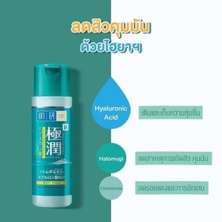 Hada Labo Blemish &amp; Oil Control Hydrating Lotion 170ml. ปรับสภาพผิวคืนความชุ่มชื่นอย่างพอเหมาะ  ช่วยลดสาเหตุการเกิดสิว