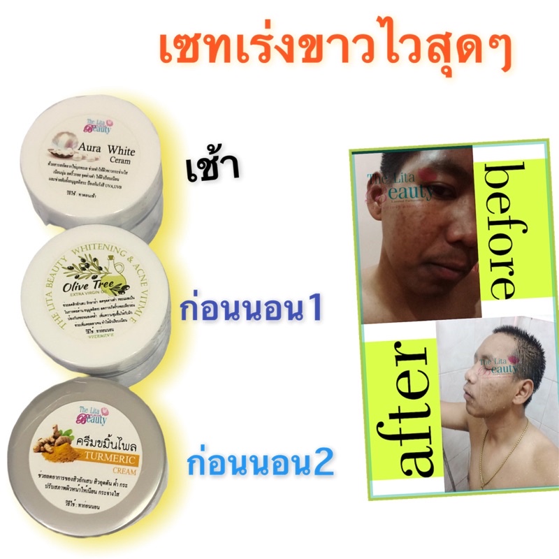 2วัน หน้าขาวมาก ตั้งแต่ครั้งแรกที่ใช้ กระปุกแรกรู้สึกได้ทันที เซทครีมโครตหน้าขาว ลดสิว ลดฝ้า ลดกระ
