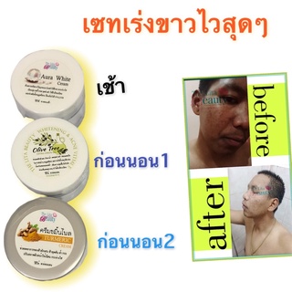 เซทครีมโครตหน้าขาว ลดสิว ลดฝ้า ลดกระ