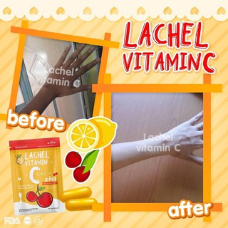 ของแท้/พร้อมส่ง Lachel Vitamin C ลาเชล ซี วิตามินซี 60แคปซูล