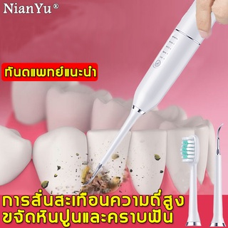 NianYu  เครื่องขูดหินปูน ทำความสะอาดและขจัดตาด ไม่ทำร้ายเหงือก ที่ขูดหินปูน เครื่องขัดฟัน