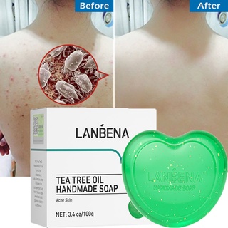 LANBENA Tea Tree Oil Handmade Soap สบู่น้ำมันทีทรี