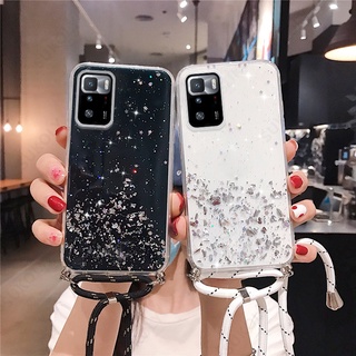 เคสป้องกันโทรศัพท์มือถืออีพ็อกซี่ใส แบบนิ่ม ลายดาว มีสายคล้อง สําหรับ Xiaomi Redmi Note 11 11S 11Pro 11EPro Note 10 10S 10Pro 9 9S 9Pro 8 8Pro