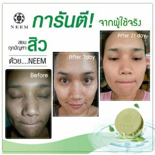 NEEM BRIGHT &amp; CLEAR ACNE SOAP 25G. สบู่รักษาสิว ดีท๊อกซ์สาร ปรับผิวขาว