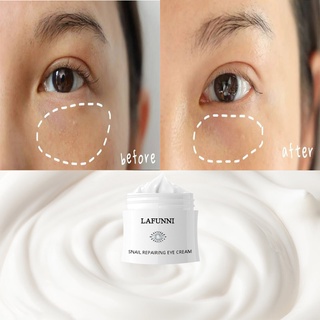 LAFUNNI Snail Nourishing Eye Cream Against Puffiness Eye Bags Moisturizing Cream Eye Care