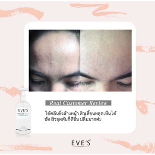 EVES TerClear Micellar Cleansing Water