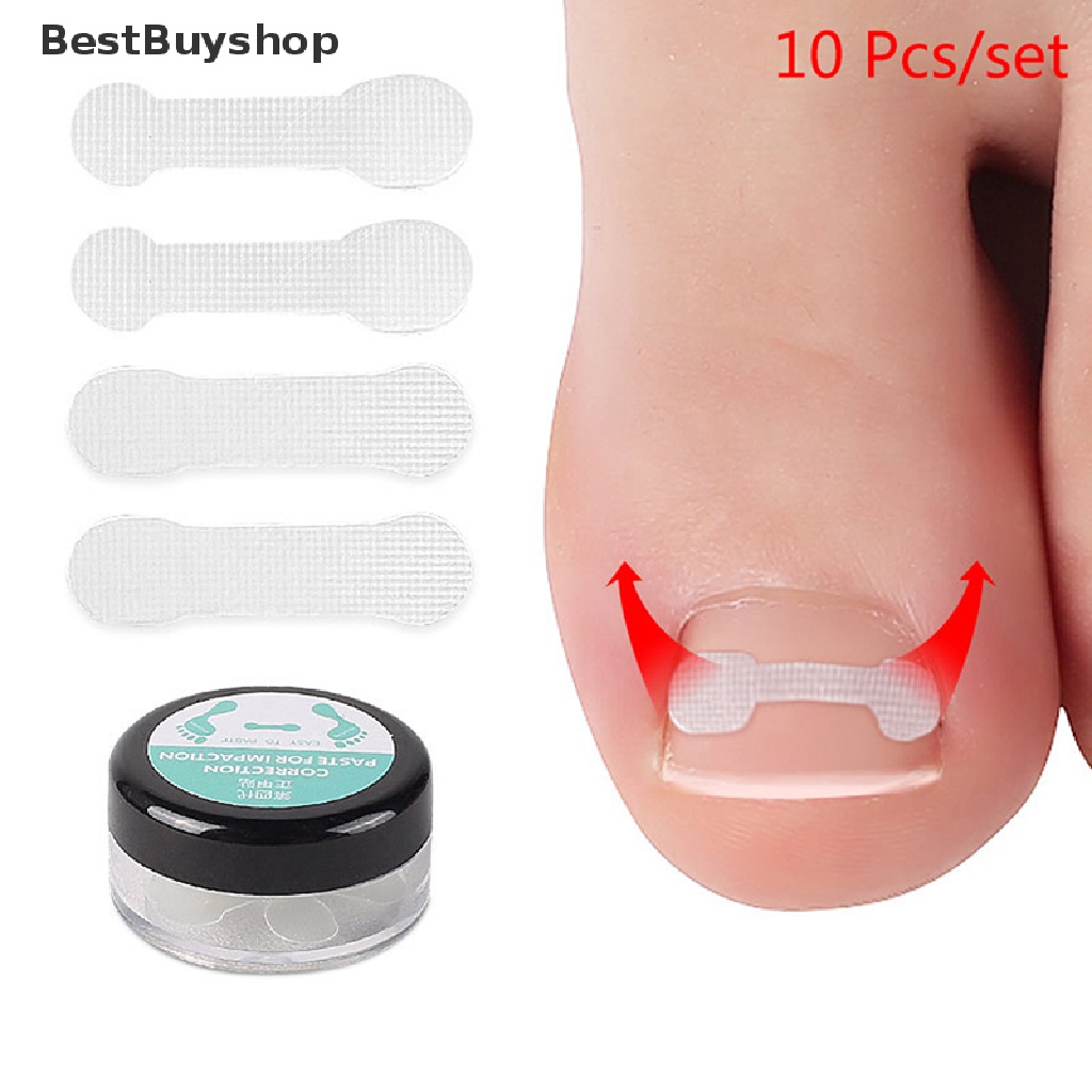 [Bestbuyshop] สติกเกอร์แก้ไขเล็บคุด 10 ชิ้น พร้อมส่ง
 #3