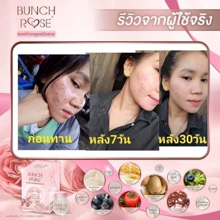 บรั้นโรเซ่ bunch Rose คอลลาเจน🌟กู้ผิวเสียให้ผิวสวย ขาว ดั่งสาวเกาหลี ผิวขาวไวกว่าฉีด