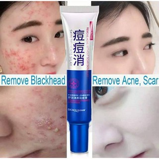 BIOAQUA Acne cream ครีมรักษาสิว เจลรักษาสิว  รหัสสินค้า 030