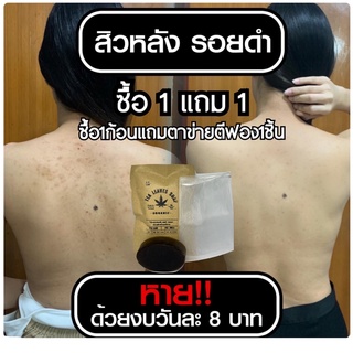 สบู่รักษาสิวที่หลัง หน้าอก ใบหน้า สูตรแพทย์แผนไทย สบู่ใบชา สบู่ใบชารักษาสิว