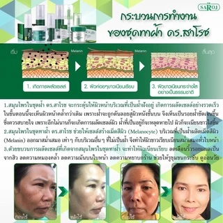 ดร.สาโรช ไฮโกล โลชั่น รักษาฝ้า สำหรับ หน้ามันมาก x2 Hi glow
