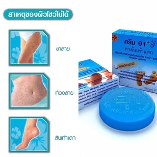 Cream 91E 8.3 g. ครีม วิตามินอี ทาส้นเท้าแตก เพิ่มความชุ่มชื้น บำรุงผิว ท้องลาย ผิวลาย