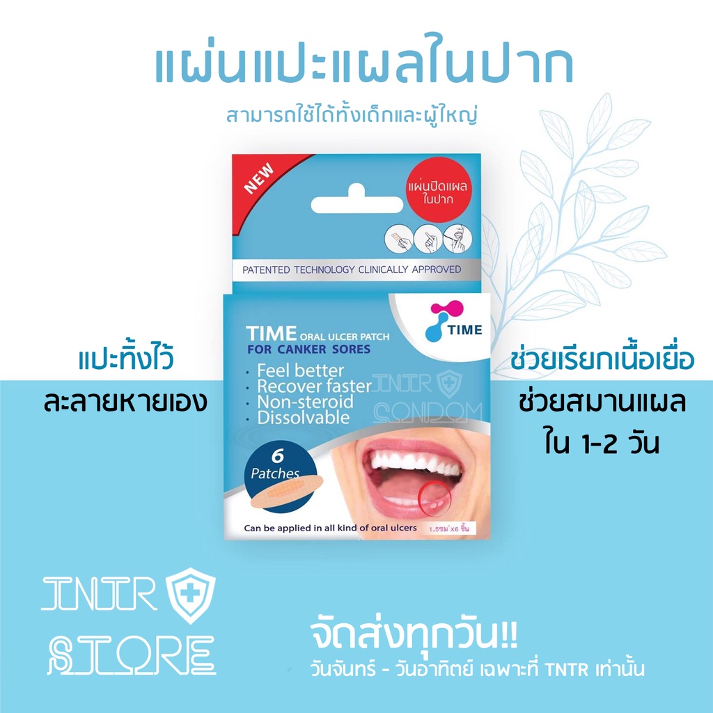 แผ่นแปะร้อนในแบบละลาย TIME ORAL ULCER PATCH ร้อนใน (แบบบรรจุ 4 ชิ้น และ รุ่นกล่อง บรรจุ 6 ชิ้น)