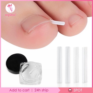 [MEGIDEAL] เครื่องมือดูแลเล็บคุด ดูแลเล็บเท้า