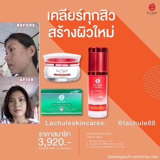 💋inboxรับส่วนลดทันที20%📌 ชุดเคลียร์สิว 3 ชิ้น