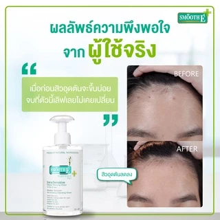 [ไม่มีซีล] Smooth E Extra Sensitive Make Up Cleansing Water สมูท อี คลีนซิ่ง วอเตอร์ - เช็ดทำความสะอาดผิวหน้า