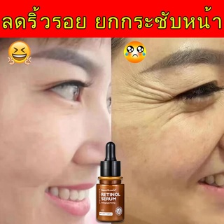 เซรั่มบำรุงหน้า เซรัมหน้าขาวใส เซรั่มหน้าเด็ก กระชับ/ยกกระชับ ต่อต้านริ้วรอย หน้าชุ่มชื้น ผิวแพ้ง่ายใช้ได้ค Retinolserum