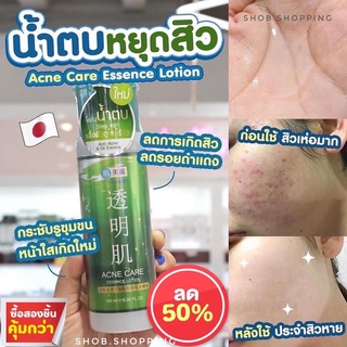 [มาใหม่] โลชั่นน้ำตบ HADABIREI ACNE CARE ESSENCE LOTION ขนาด 180 ml  สูตรเพื่อลดสาเหตุของการเกิดสิว