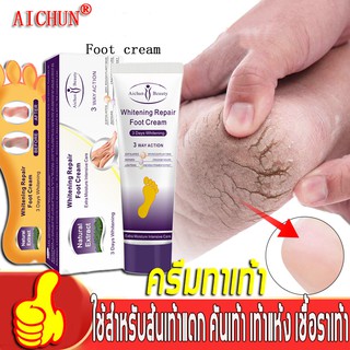 Aichun ครีมทาเท้าแตก 100g แก้ไขปัญหาต่าง ๆ เช่นมือและเท้าที่แห้งแตก คัน เป็นขุย และผิวหยาบกร้าน ครีมทาเท้า ครีมทาเท้าแตก