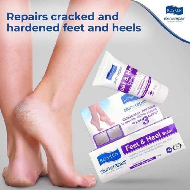 พร้อมส่ง✅ Rosken Feet & Heel Cream 50g