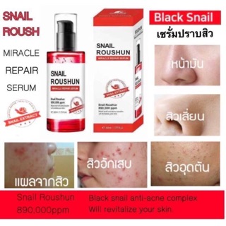 เซั่รั่ม SNAIL ROUSHUN MIRACLE REPAIR SERUM  จาก ROUSHUNเซรั่มเมือกหอยทากสีดำ