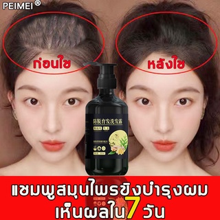 ZHENXIU แชมพูสมุนไพรขิงบำรุงผม 250ml แชมพูผมร่วง แชมพูขิงเพียว เซรั่มผมยาวไว เร่งผมเกิดใหม่ ผมยาวไว แชมพูปลูกผมดก สำหรับ