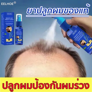 【บอกลาหัวล้าน】EELHOE เซรั่มปลูกผม 30ml น้ำยาเร่งผมยาว ปลูกผม ​บำรุงรากผม ป้องกันผมร่วง ยาปลูกผมของแท้ บำรุงผม ที่ปลูกผม