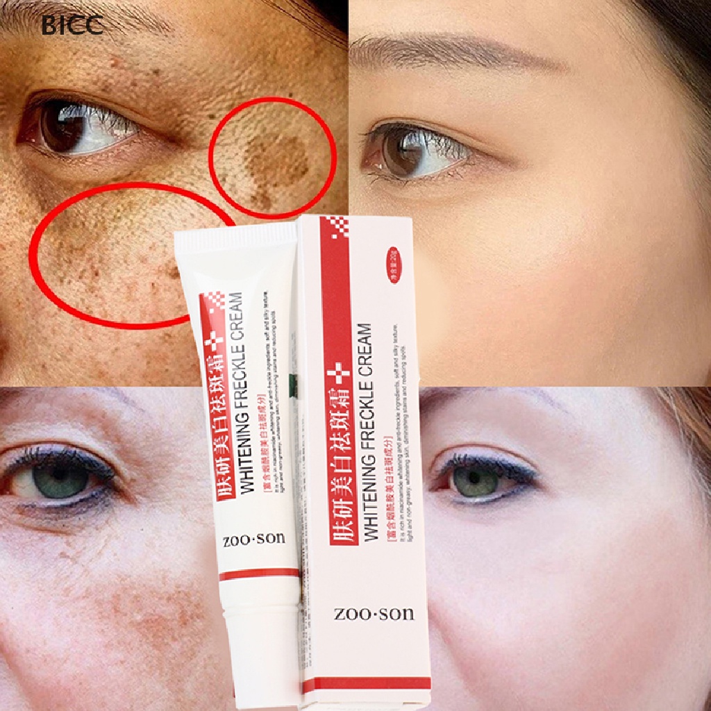 BI Freckle Cream Remove Skin Melasma Acne Spot Pigment Melanin Dark Spots Whitening CC