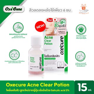 Oxecure Acne Clear Potion 15ml. สูตรลับไร้สิวด้วยแป้งน้ำชมพูแต้มสิว อ๊อกซีเคียว