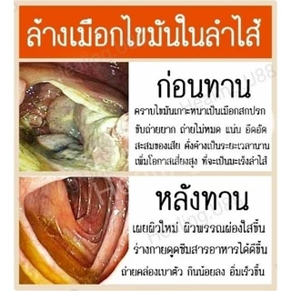 🌱อัลฟัลฟ่า​ Alflafa​🎖️ของแท้💯% มีรีวิว​จริง👍💥ล้างพิษ​ สร้างภูมิ ผิวใส​ ผิวขาว​ ดี​ท็อกซ์​ detox​ กรดไหลย้อน​ อัลฟาฟ่า