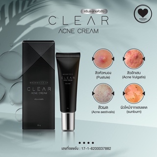 มาดามกิ๊กกี้ Clear Acne Cream Plus ครีมละลายหัวสิว มาดามกิ๊กกี้ ลดอักเสบ ฆ่าเชื้อสิว MADAMKIKKIEY