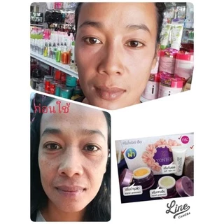 ครีมโยนิเซ่-yonise-cream