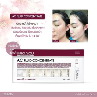 EXP:2025) ของแท้ล๊อตใหม่ Proyou AC Fluid Concentrate เซรั่ม โปรยู เอซี แอมพูล รักษาสิว แอมพลูโปรยู เซรั่มโปรยู สิว ผด