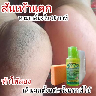 แท้‼️น้ำยาขัดส้นเท้าแตก สมุนไพรสปาเท้าแตกสุภาพร 60ml. แถมฟรี!!อุปกรณ์ขัดครบเช็ต