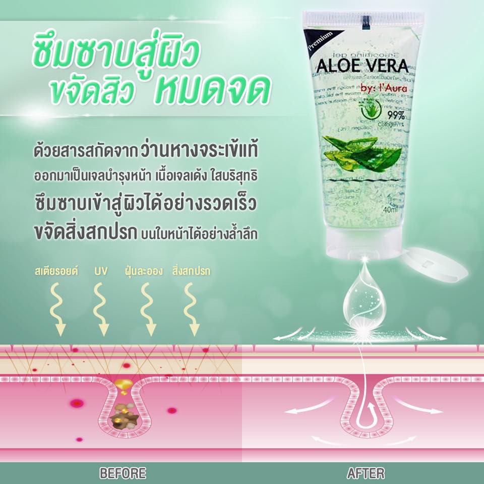 เจลว่านหางจระเข้ I'AURA