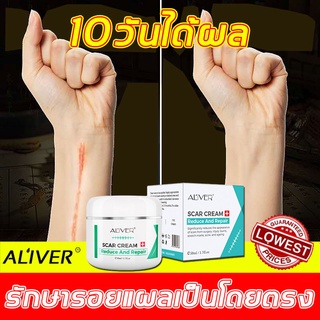 ALIVER ครีมลดรอยแผลเป็น 50ML ทาแผลเป็นนูน  ยับยั้งการเกิดแผลเป็นใหม่ ครีมลดแผลเป็น  ยับยั้ง ครีมลดแผลเป็น ครีมลบแผลเป็น