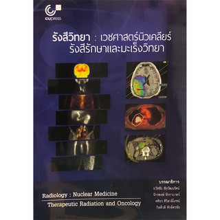 Chulabook(ศูนย์หนังสือจุฬาฯ) |C112หนังสือ9789740339151รังสีวิทยา :เวชศาสตร์นิวเคลียร์ รังสีรักษาและมะเร็งวิทยา