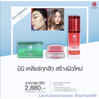 💋inboxรับส่วนลดทันที20%📌 ชุดเคลียร์หน้าสิว ให้หน้าใส