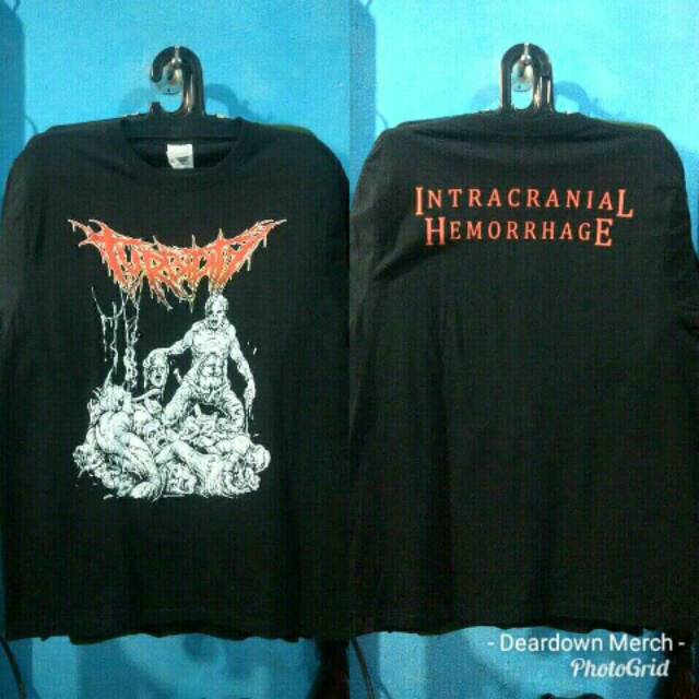 TS TURBIDITY - INTRACRUNIAL