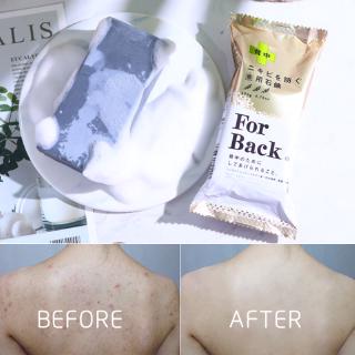 【Beautyhouse】Back Acne Soap135 กรัม