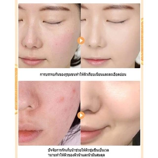VC โทนเนอร์ ช่วยควบคุมความมัน ช่วยกระชับรูขุมขน หน้าเด้ง กระจ่างใส ด้วย VC โทนเนอร์ วิตามินซีเข้มข้น toner