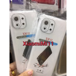 Xiaomi Mi 11 CASE TPU ฝาหลังใส กันกระแทก มีปุ่มกันกระแทก คลุมกล้อง ทั้ง 4 มุม รุ่นใหม่