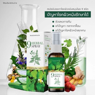 ส่งฟรี ✅ สเปรย์ 9 Herbal spray สังคัง กลากเกลื้อน ผิวอักเสบ สะเก็ดเงิน ผื่นคัน คันในร่มผ้า เชื้อราหนังศรีษะ