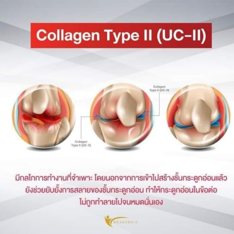 คอลลา ทู-ดี พลัส Colla2-D plus คอลลาเจนบำรุงข้อและกระดูกเสื่อม