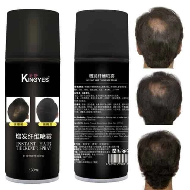 ***พร้อมส่ง***(ขวดใหญ่) kingyesสเปรย์ผม ปิดผมขาว ปิดผมบาง แก้ปัญหาหัวล้าน(ขวดดำ)