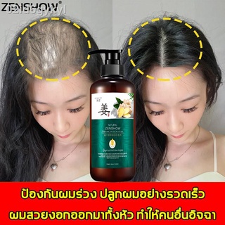 Zenshow แชมพูขิงเพียว แชมพูแก้ผมร่วง ผมร่วง รักษาผม รักษาผมร่วง ป้องกันผมร่วง เคราตินบำรุงผม ผมร่วงผมบาง หงอก ปลูกผมเร่ง