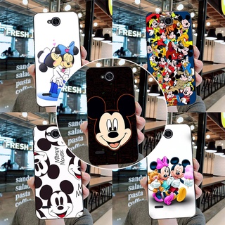 เคสโทรศัพท์มือถือ ซิลิโคนนิ่ม TPU ลายมิกกี้เมาส์ สําหรับ LG X power 2 II M320N X500 K10 power 5.5 นิ้ว