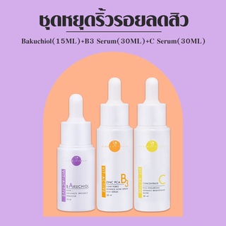 VIKKASKINCARE Vit-Active A 5% Bakuchiol15 ml +  Vit-Active B Zinc PCA  30ml+ Vit-Active C 20%AA2G 30ml